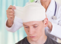 10 Tips For Making an Injury Claim for Concussion in 2024
