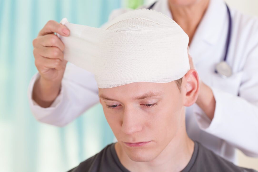 10 Tips For Making an Injury Claim for Concussion in 2024