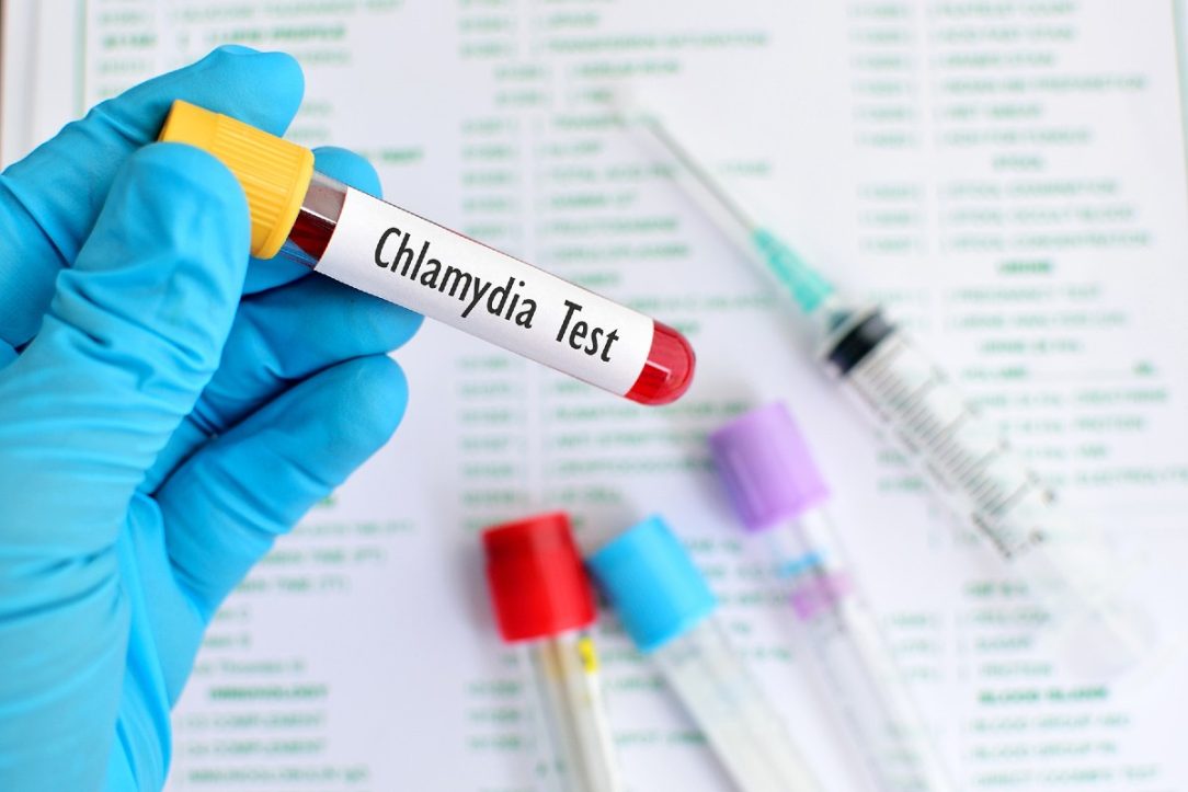 How Accurate Are Rapid Chlamydia Tests?