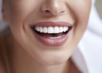 Are Dental Veneers Right for You? Here Are the Pros and Cons