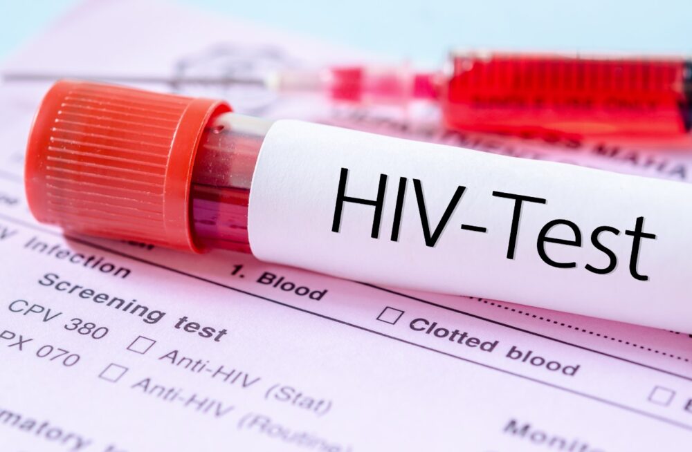 HIV Prevention Methods